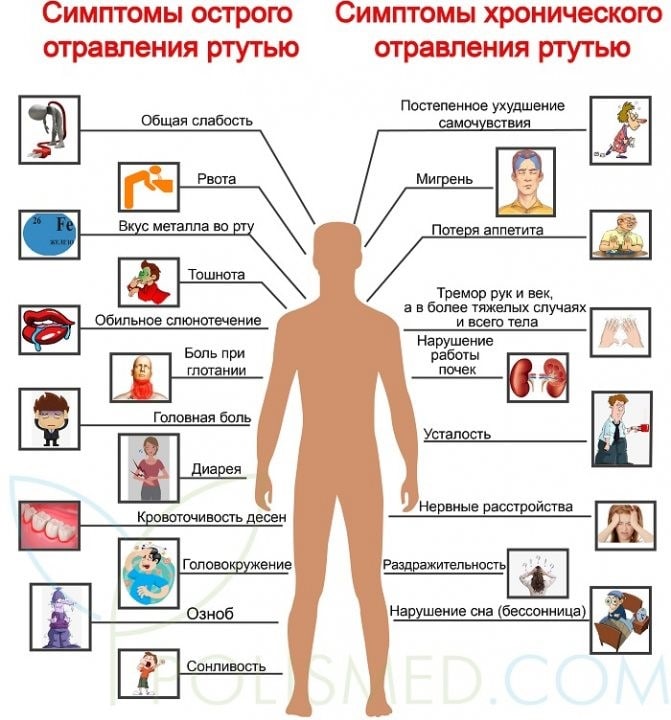 ртутное отравление